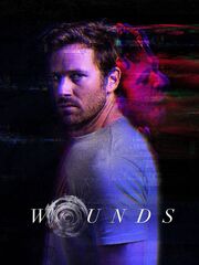 Wounds