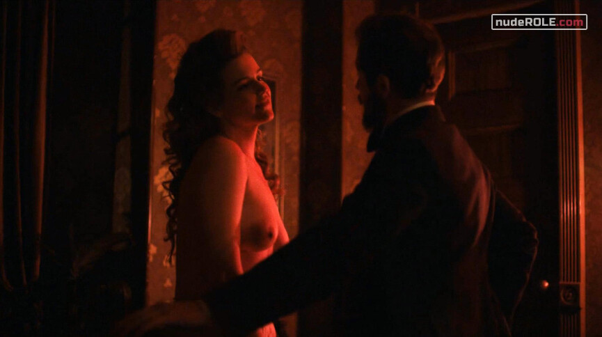 3. Susie nude – The Knick s02e04 (2015)